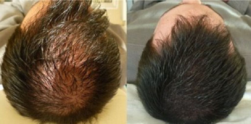 Perfect YOU Permanent Cosmetics  DAILY: 7 am - 9 pm near Le Merigot Hotel