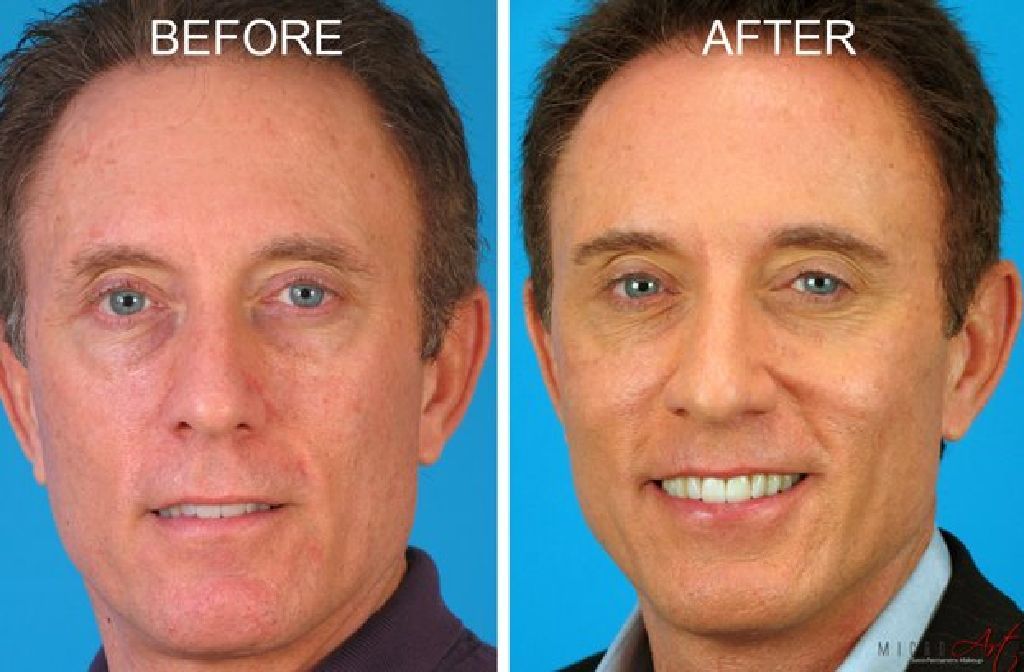 Permanent Makeup, Tattoo Removal Evansville, near Casino