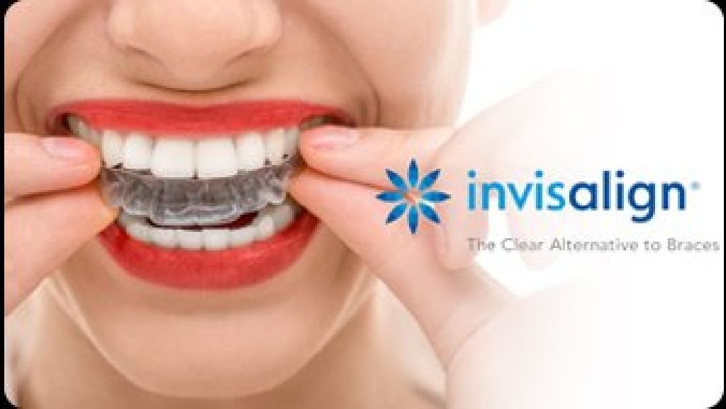 Patient Testimonial for Smile matters Dentistry - Dentist in Brampton