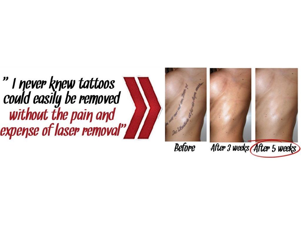 100% ORGANIC PAINLESS TATTOO REMOVAL!