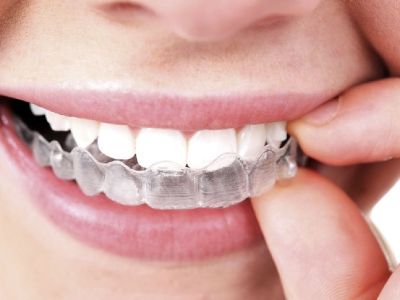 Improve your Appearance with Invisible Braces Philadelphia