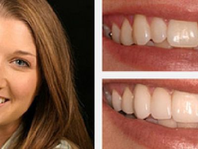 Dr. Jenifer C. Back - Sarasota's Premier Cosmetic Dentist