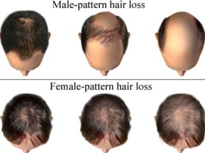 Are You Losing Hair?