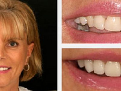 Cosmetic Dentist Sarasota - Dr. Jenifer C. Back