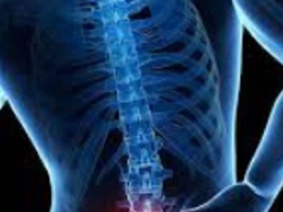 Consult a Specialist for Spondylosis Treatment in Plano, Tx