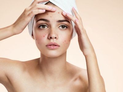Acne Treatment in Honolulu | Helen's Haven