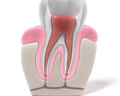 General & Cosmetic Dentistry in Palo Alto | Advanced Dental Care Center