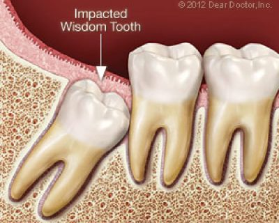 Our practice ensures a positive dentist office experience for you and your loved ones by focusing on family dentistry that incorporates a wide-range of dental services and specialties.For More Details Visit:-http://hunterdonfamilydentalnj.com