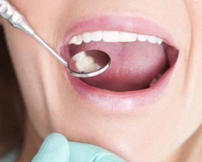 We here at Kings Family Dentistry promise to provide an honest, judgment-free environment at our Dental Clinic in Brooklyn where it all comes down to great care. Patients should contact the dental offices directly for all questions concerning their dental treatment.