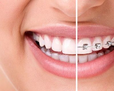Book an Appointment for Orthodontist in Idaho Falls Call at (208) 356-3300